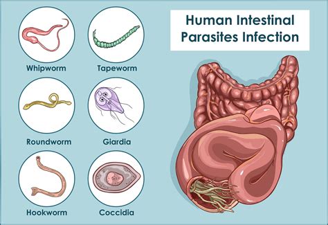 parasited|[BIG SPOILERS] Help Me Understand One Part About Parasite